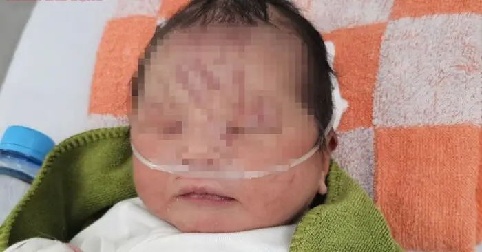 bé sơ sinh bị vùi lấp