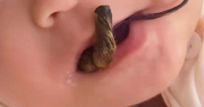 tay khỉ khô ngừa bệnh cam