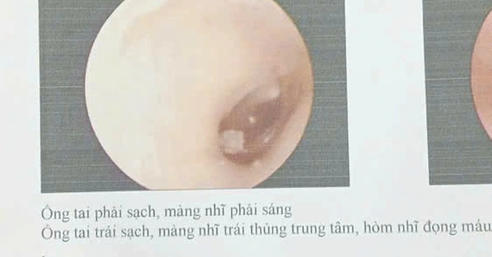 học sinh lớp 8