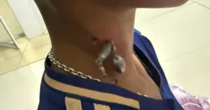 Cháu bé 13 tuổi