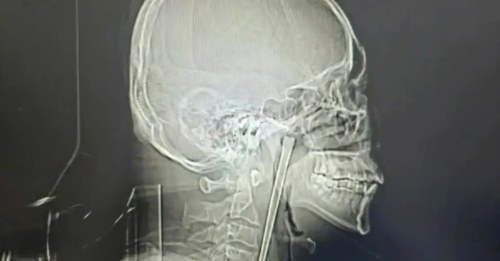 Người đàn ông Trung Quốc