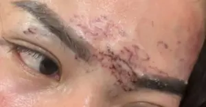 vụ xăm mặt Cà Mau