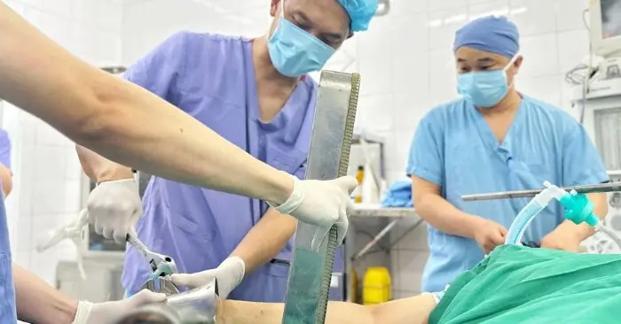 kẹt tay vào máy xay thịt