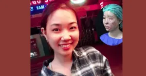 Nữ sinh bị tạt axit nhầm