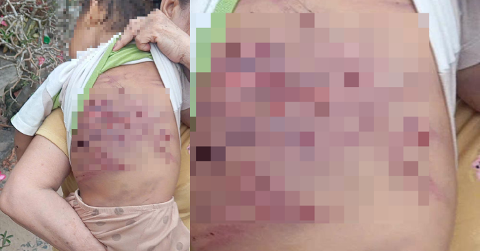 bé trai 2 tuổi bị bạo hành
