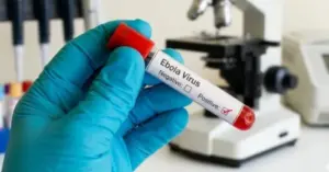 ngăn chặn virus Ebola