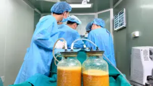 Bác sĩ phẫu thuật lấy gần 5 lít dịch, máu và chất lạ trong ngực nữ bệnh nhân sau biến chứng tiêm chất làm đầy, cảnh báo nguy cơ làm đẹp thiếu an toàn.