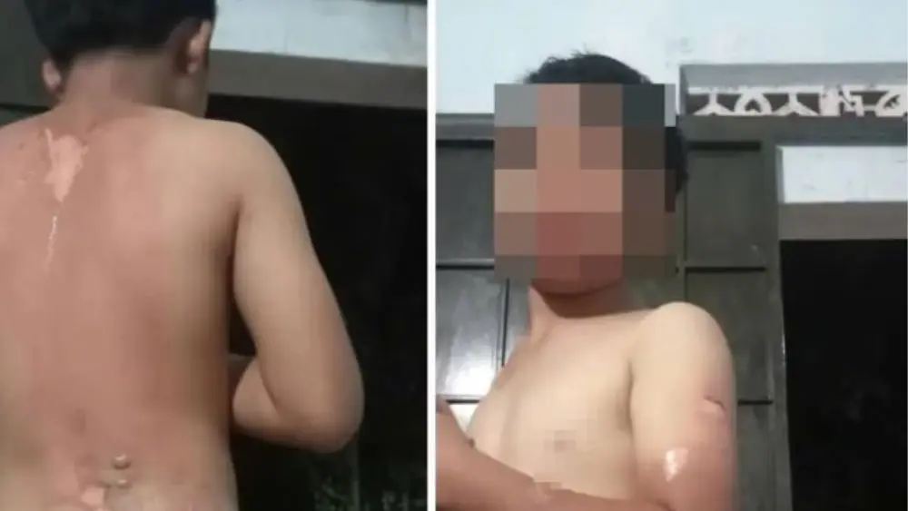 Công an xã Ea Đrăng, Đắk Lắk đang xác minh thông tin bé trai nghi bị mẹ tạt nước sôi sau phản ánh lan truyền trên mạng xã hội.