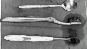 Bác sĩ phẫu thuật lấy 2 bàn chải và một thìa inox khỏi dạ dày nam bệnh nhân, cảnh báo nguy cơ nuốt dị vật ở người mắc hội chứng Pica.