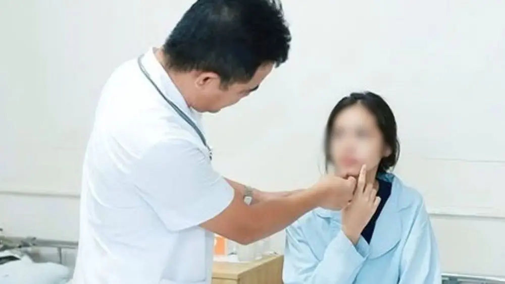 Nữ sinh 14 tuổi ở Thanh Hóa bị méo miệng, lệch mặt sau một đêm nằm điều hòa và được xác định liệt dây thần kinh số VII.
