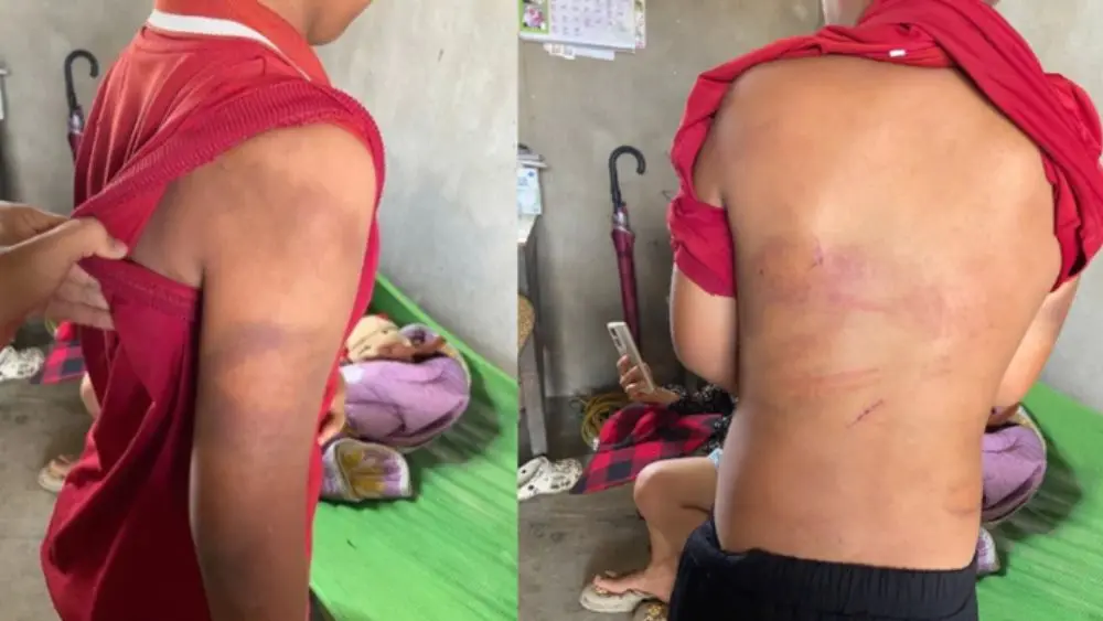 Vụ bé trai 10 tuổi bị bạo hành ở Nghệ An: Người cha sắp hầu tòa, diễn biến vụ việc thu hút sự quan tâm của dư luận.
