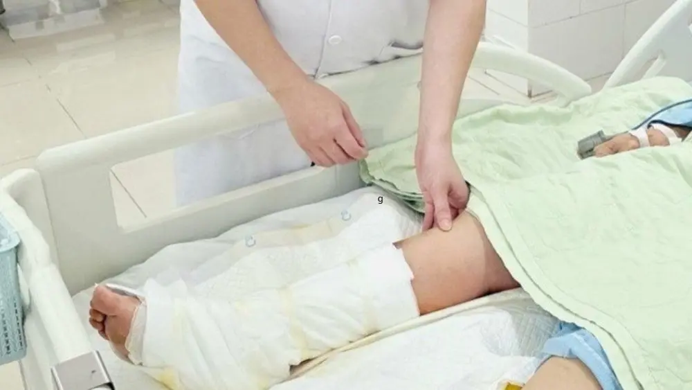 Chân phải của người phụ nữ 65 tuổi bị sưng nề, hoại tử mô mềm sau khi đắp lá ớt.